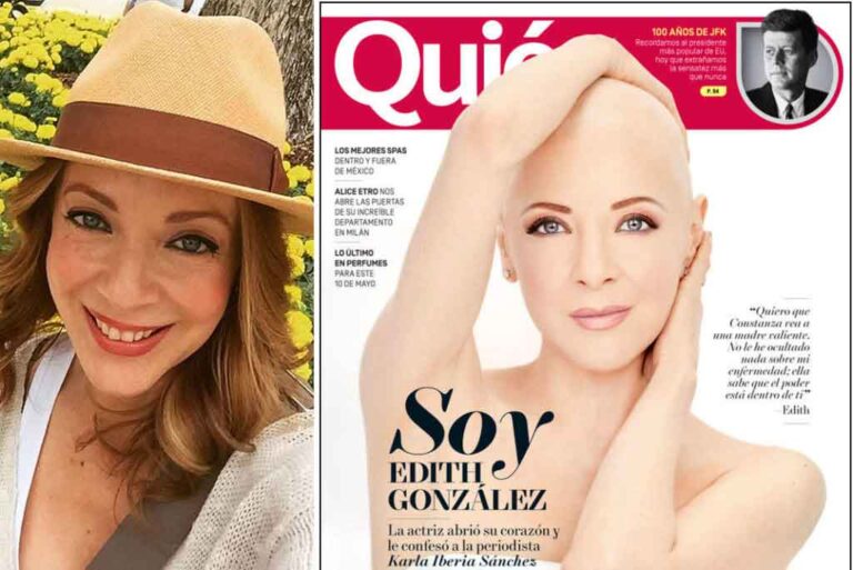 Edith González posa sin cabello