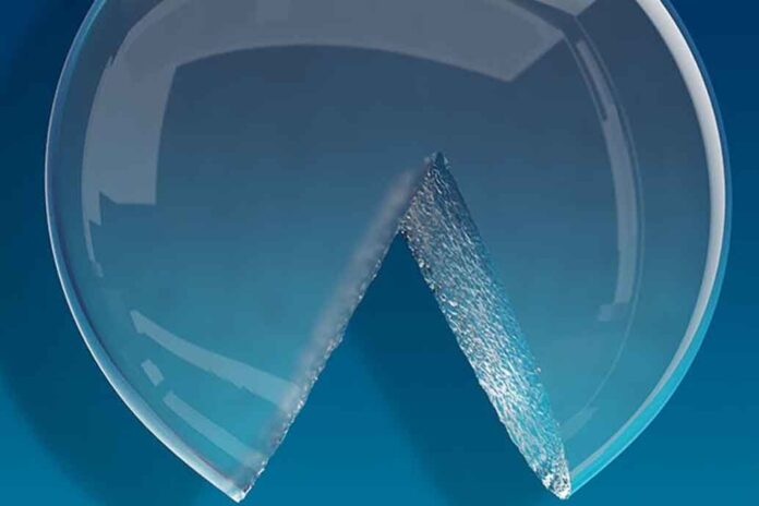 implantes-gummy-bear Imagen cortesía Natrelle, implantes mamarios.