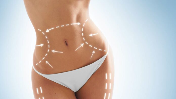 Tummy Tuck Tummy Tuck