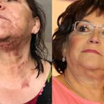 Así quedó Doña Rosa después del accidente casero