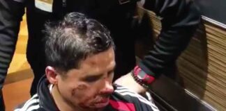Así lucía el rostro del cantante tras ser atendidas de las heridas en su rostro
