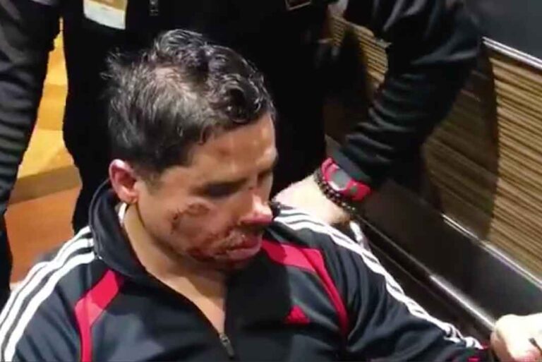 Así lucía el rostro del cantante tras ser atendidas de las heridas en su rostro