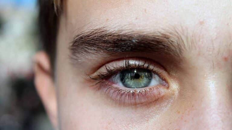 Dr. Wolf: Tengo las cejas caídas ¿puedo levantarlas?