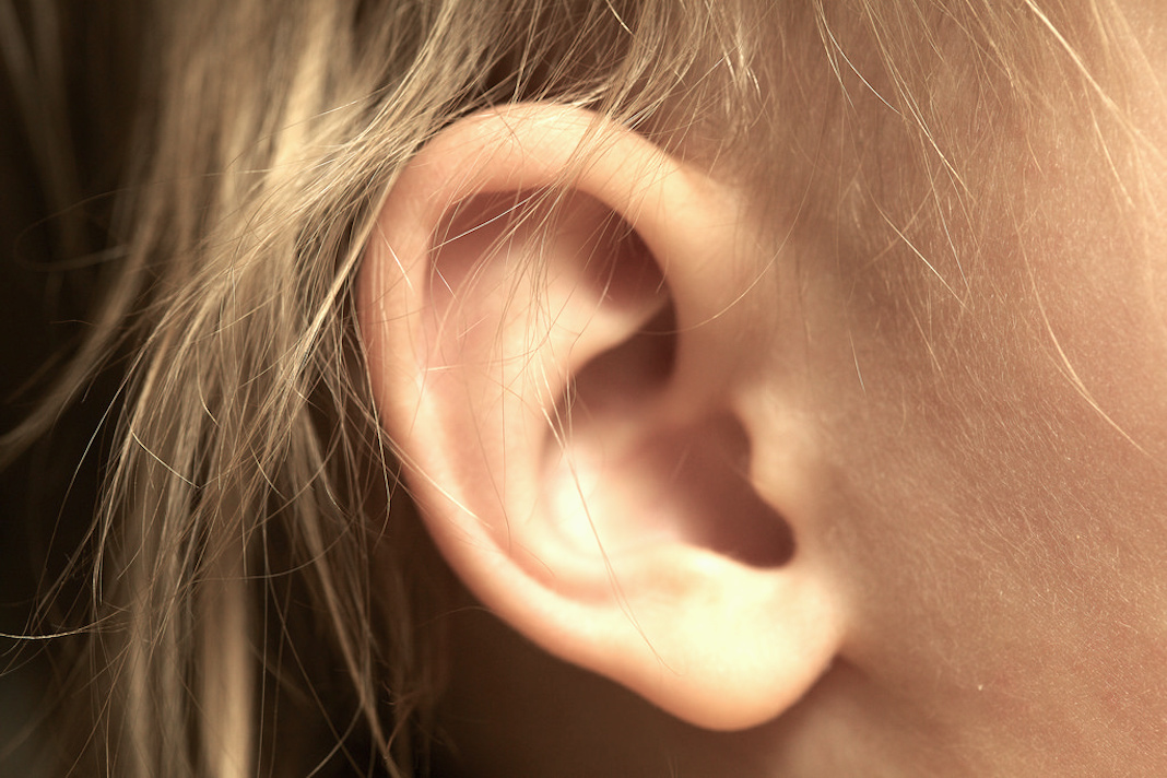 Corregir orejas prominentes es una operación rápida.
