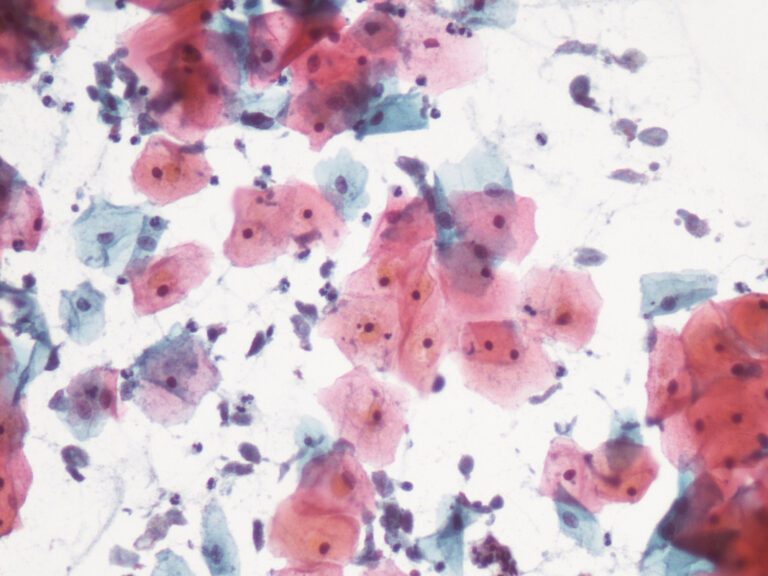 Ingrid Macher: ¿Tienes parásitos en tu cuerpo? ¡Aquí cómo eliminarlos!