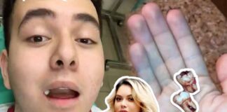 A Johnny Rivera le sacaron dos muelas luego de estar sufriendo varios días de un intenso dolor