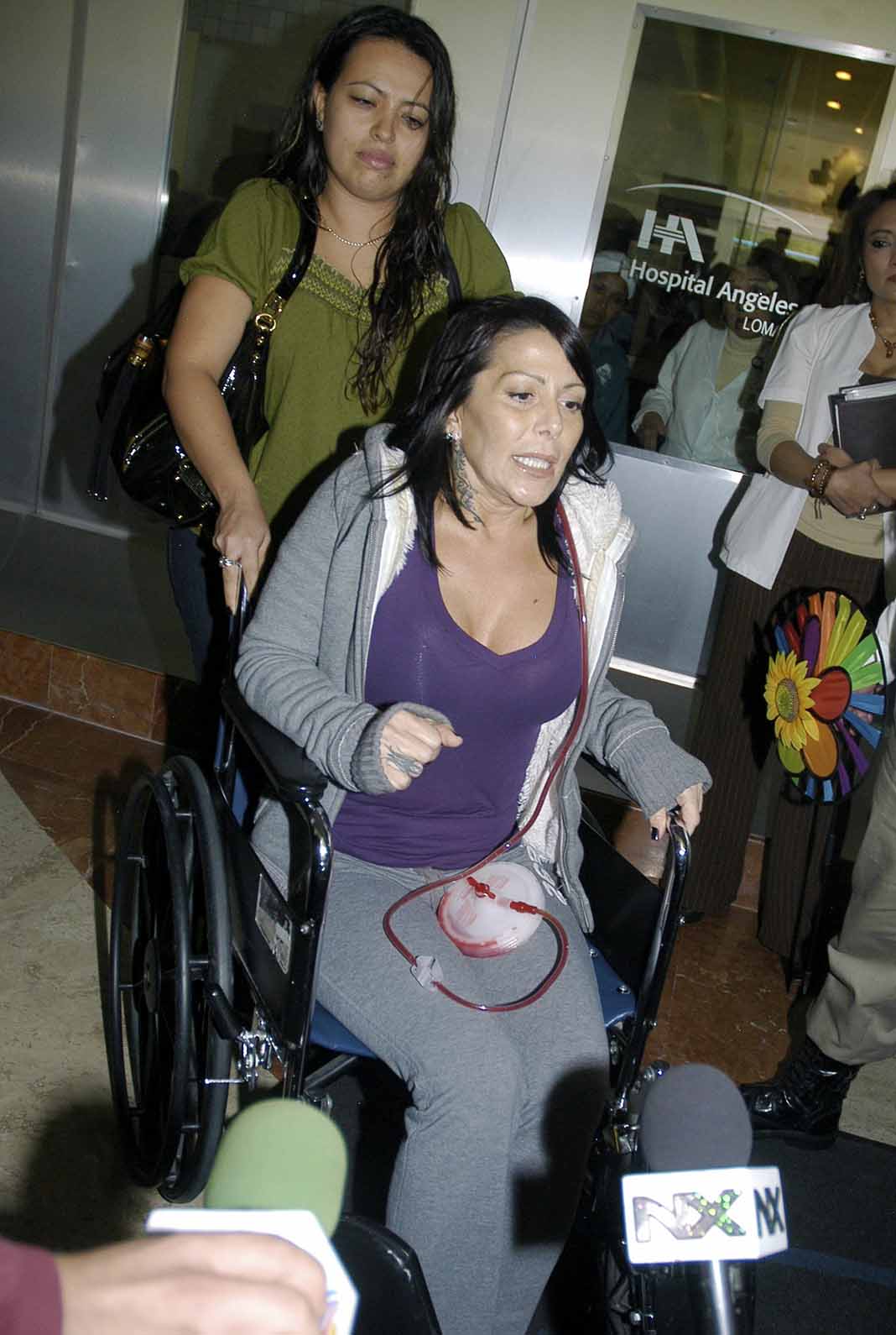 Alejandra al salir del hospital la primera vez que fue operada en 2012
