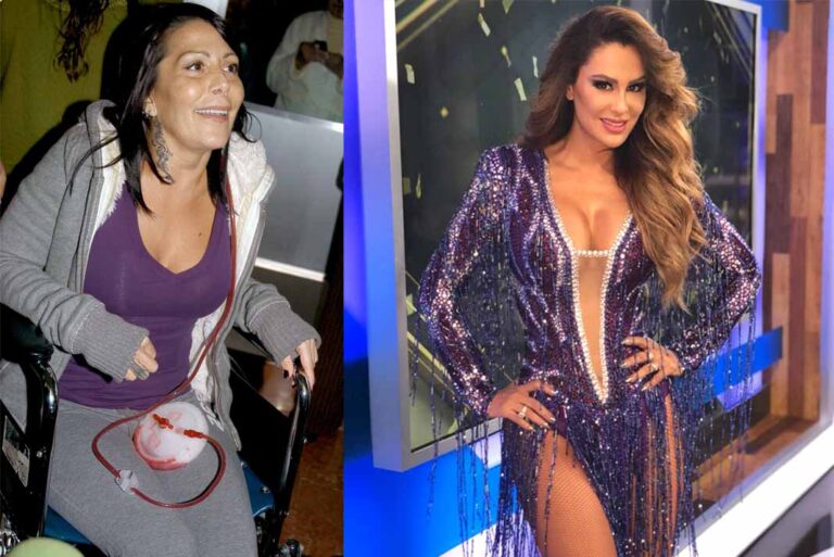 Que a Ninel Conde también le inyectaron polímeros en los glúteos