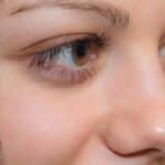 Ojeras