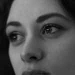 Ojeras-3
