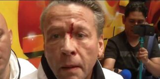 El actor salió sangrando de la reunión con su oponente y la prensa