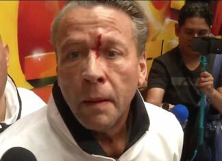 El actor salió sangrando de la reunión con su oponente y la prensa