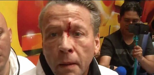 El actor salió sangrando de la reunión con su oponente y la prensa