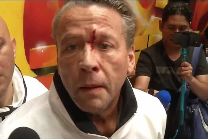 El actor salió sangrando de la reunión con su oponente y la prensa