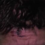 Esta es la herida en la frente que le hicieron los ladrones al productor de novelas