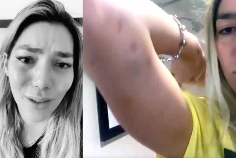 Llorando, Frida Sofía muestra pruebas de supuesta golpiza de Alejandra Guzmán