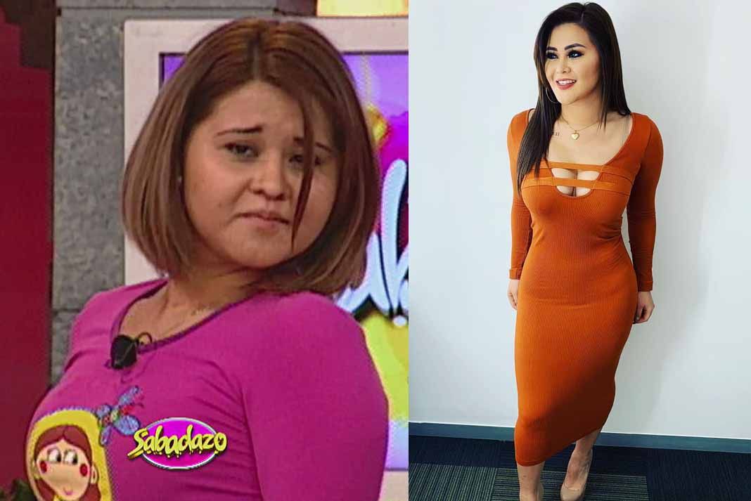 El antes y después de Araceli Ordaz, mejor conocida como Gomita