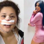 Gomita tiene cerca de 10 operaciones, más otros tantos procedimientos estéticos