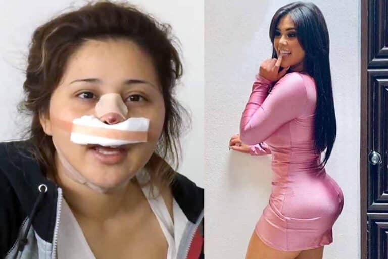 Gomita tiene cerca de 10 operaciones, más otros tantos procedimientos estéticos