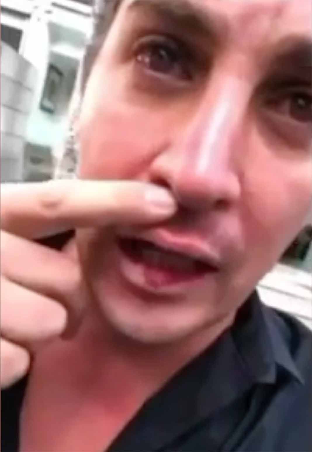 El actor lloró en uno de los videos que compartió y mostró las supuestas heridas por los golpes