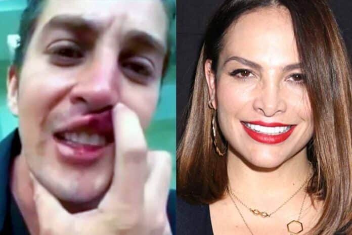 El actor Jonathan Islas se grabó un video asegurando que Fabiola Campomanes lo golpeó
