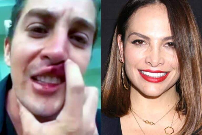 El actor Jonathan Islas se grabó un video asegurando que Fabiola Campomanes lo golpeó