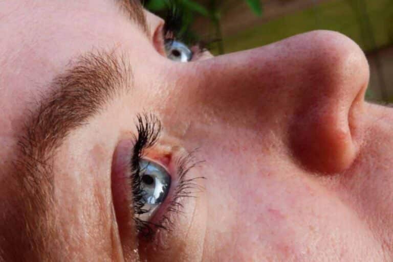 Dr. Wolf: Quiero operarme los párpados caídos, pero tengo miedo a las cicatrices