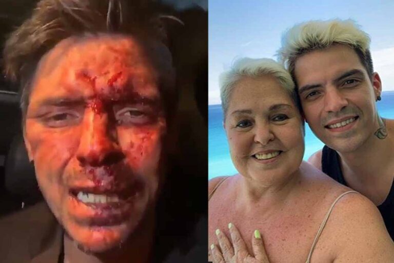 Hijo de Lupita D'Alessio acusa a Arturo Montiel de brutal golpiza