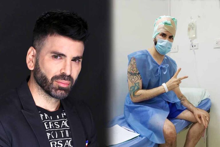 "Fui súper estúpido": Lo que le pasó a Jomari Goyso por "vanidad"