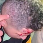 El novio de Mayeli mostró los golpes que recibió en la cabeza con la cacha o culata de una pistola