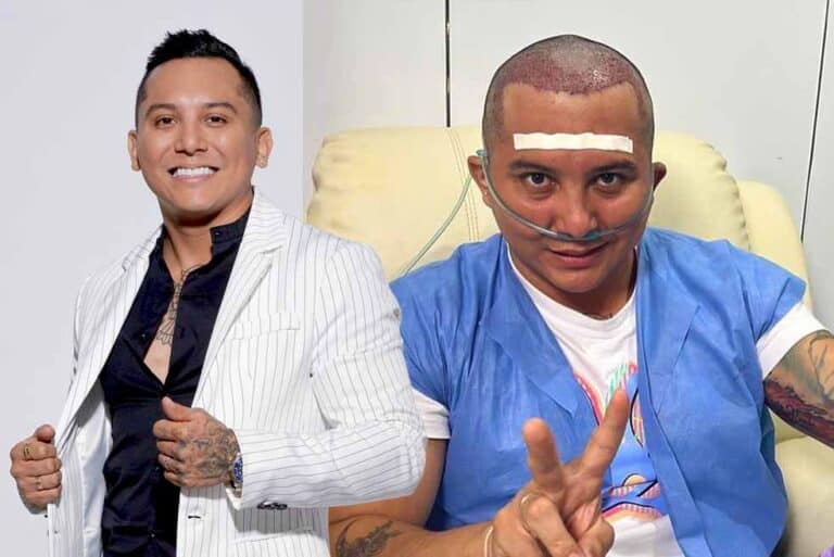 Edwin Luna se hizo un trasplante capilar: "Me estaba quedando sin tierra en la maceta"