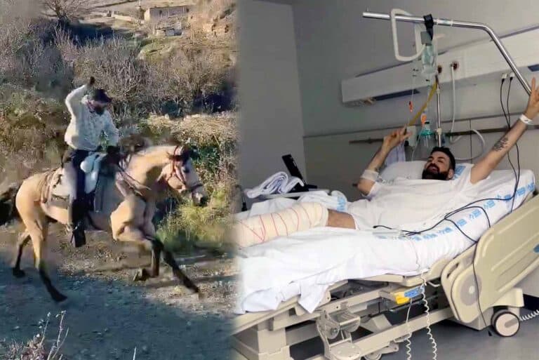 ¿Se cayó del caballo? Jomari Goyso publica video cabalgando, y luego en el hospital