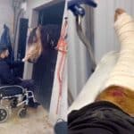 Preocupado por cómo se encontraba su caballo, Jomari pidió verlo y ser operado hasta un día después; así fue que estuvo unos momentos con él