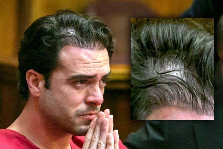 Afirman que de tanto estrés, a Pablo Lyle le dio alopecia y se le está cayendo el cabello