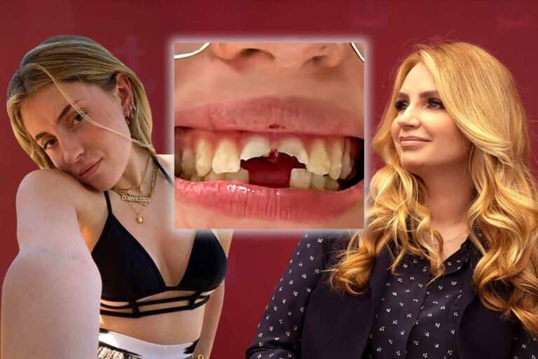 Hija de Angélica Rivera pierde sus dientes en aparatoso accidente a caballo