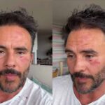 Con golpes y heridas en el rostro, el actor compartió a través de un video que fue asaltado por cinco delincuentes en compañía de sus hijos