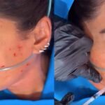 La especialista le inyectó el rostro a la presentadora para refrescar su piel, pero no dijo qué fue lo que le aplicó