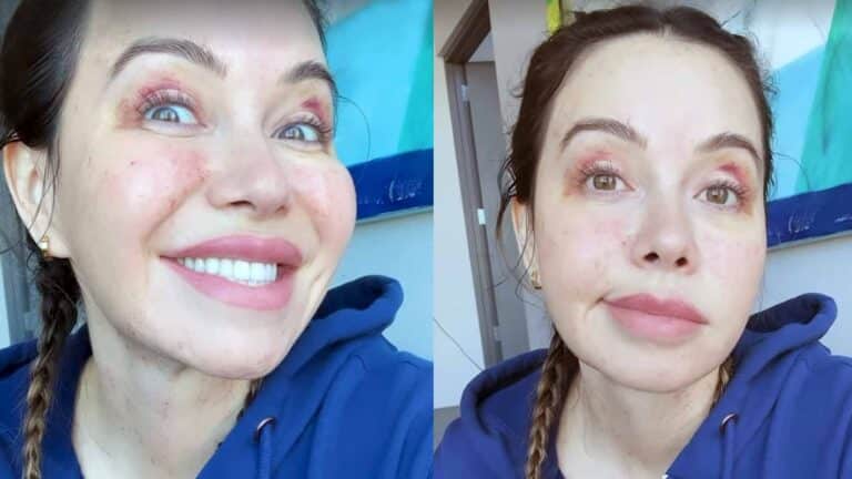 Chiquis Rivera se arregla párpados, cuello, abdomen y bubies en una sola sesión