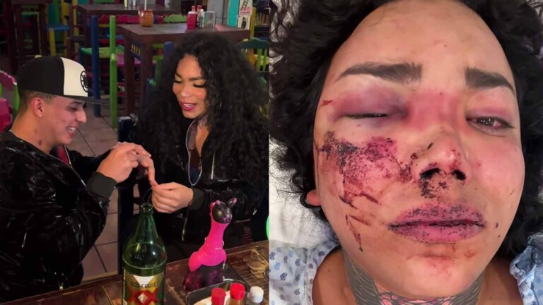 A Paola Suárez su novio le pide matrimonio y por la mañana la golpea brutalmente
