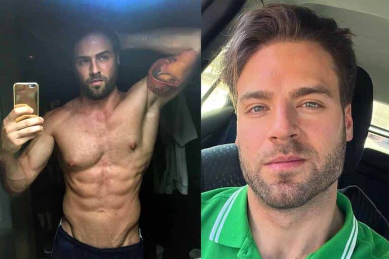 A Jorge Losa le extirparon una glándula mamaria: "Me salía líquido del pezón"