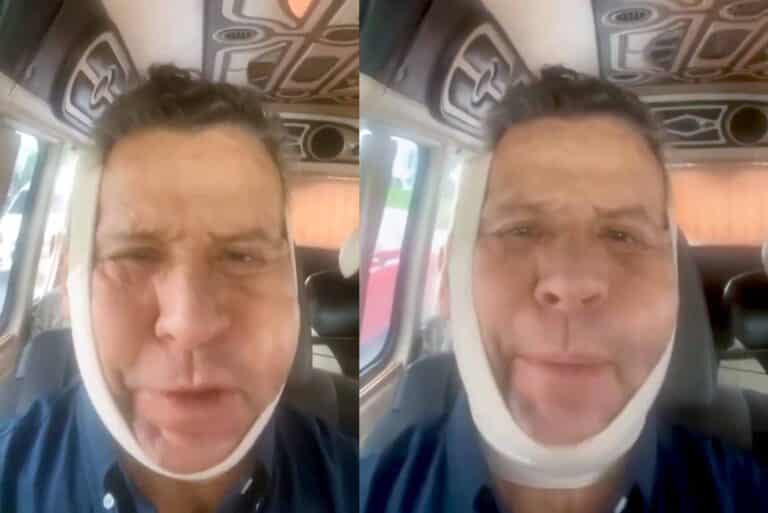 Hinchado e irreconocible: Famosísimo actor de telenovelas explica qué le pasó