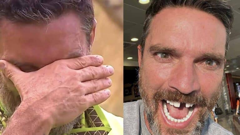 Además de desgarrarse un bíceps, Julián Gil quedó chimuelo tras caerse en 'La Isla'