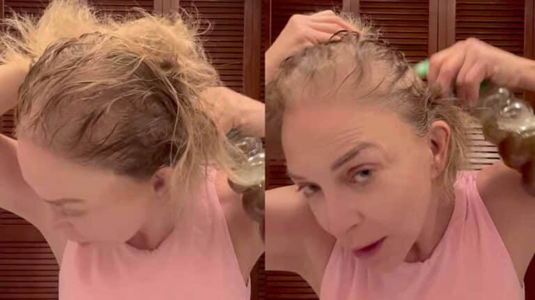 Laura Flores muestra cómo combate su alopecia y todavía la critican