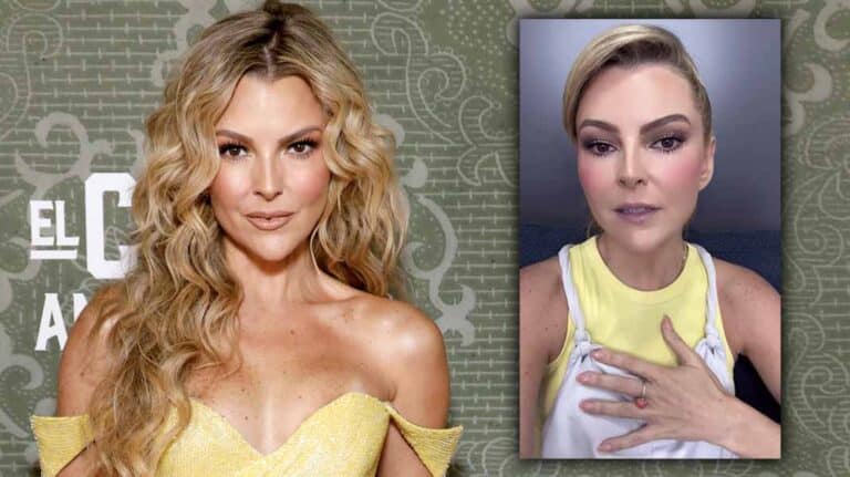 Rostro hinchado, ardor en el cuello y migrañas llevaron a Marjorie de Sousa al quirófano