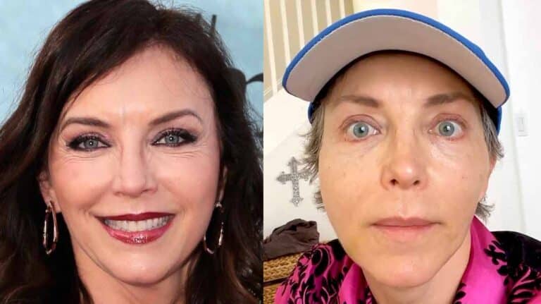 Un procedimiento estético le desfiguró la cara a Laura Flores: "Parecía hámster"