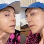 En marzo del 2023, Laura Flores mostró que estaba un poco hinchada luego de ponerle los famosos hilos tensores, sin saber que el resultado no sería el que esperaba
