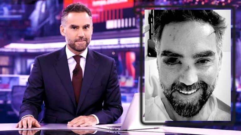 Enrique Acevedo recibe 70 puntadas tras sufrir peligrosa caída y lesiones en el rostro