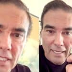 Eduardo-Yanez-DL-dedo