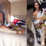 Laura compartió unos post en los que se muestra con su pierna izquierda vendada y asegura que Telemundo le está pagando sesiones de fisioterapia