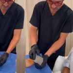 El cirujano Carlos Valle le muestra a Fabiola cómo los implantes, quitándoles la cubierta, ya presentaban deformidad y líquido que se estaba saliendo